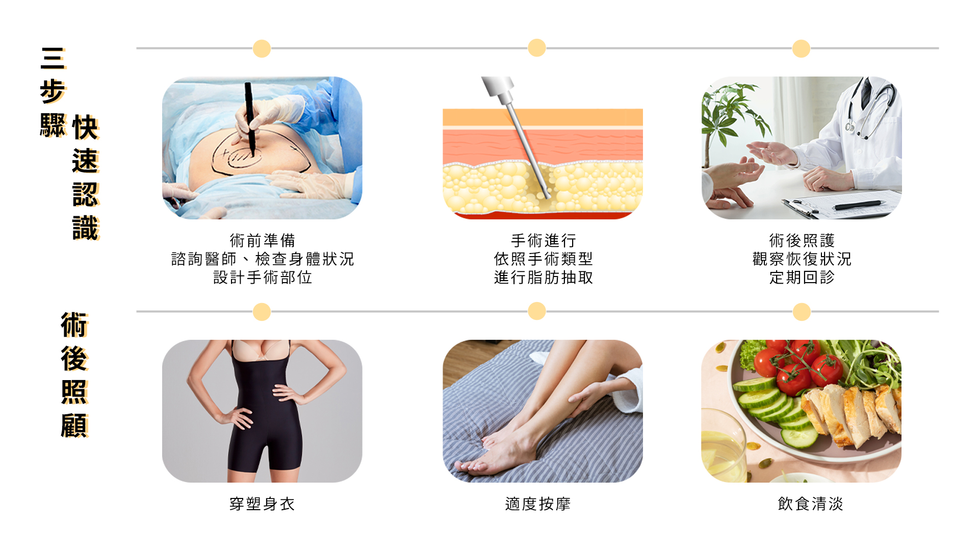 抽脂手術流程