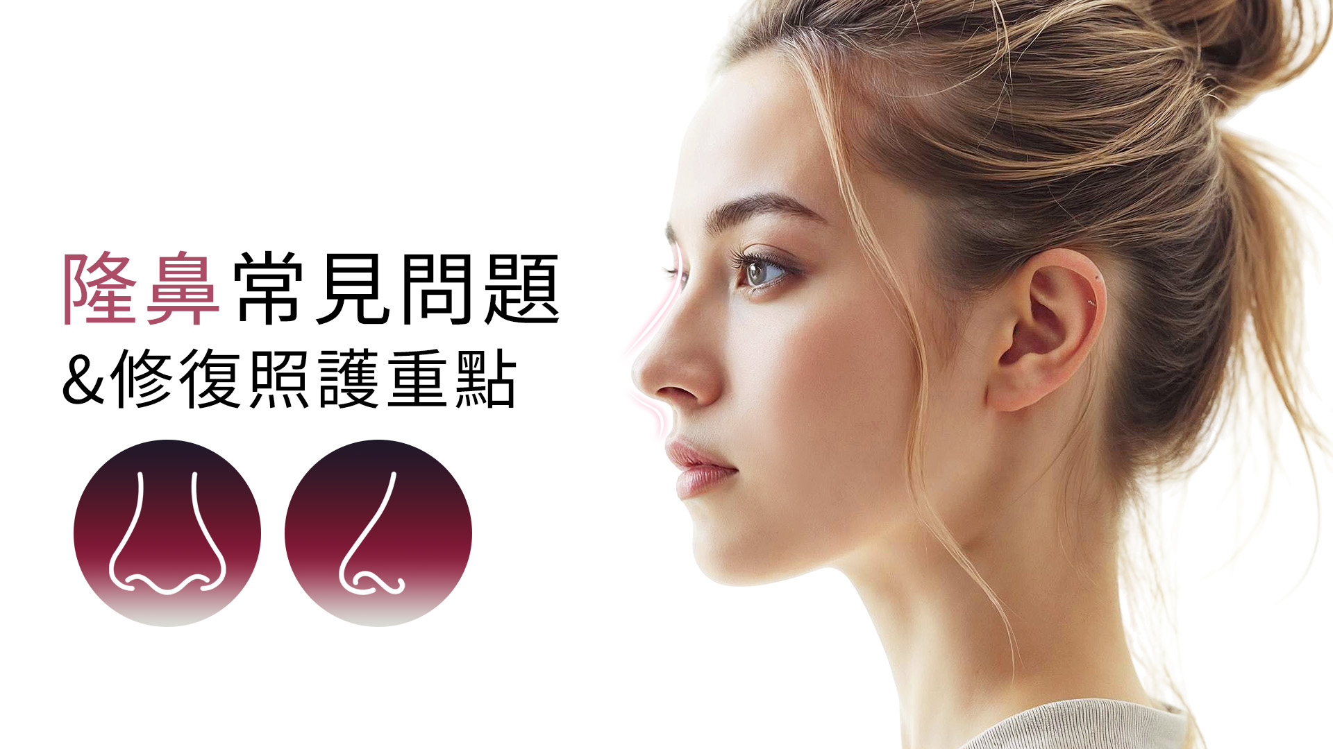 台南隆鼻恢復期-台南教主醫美