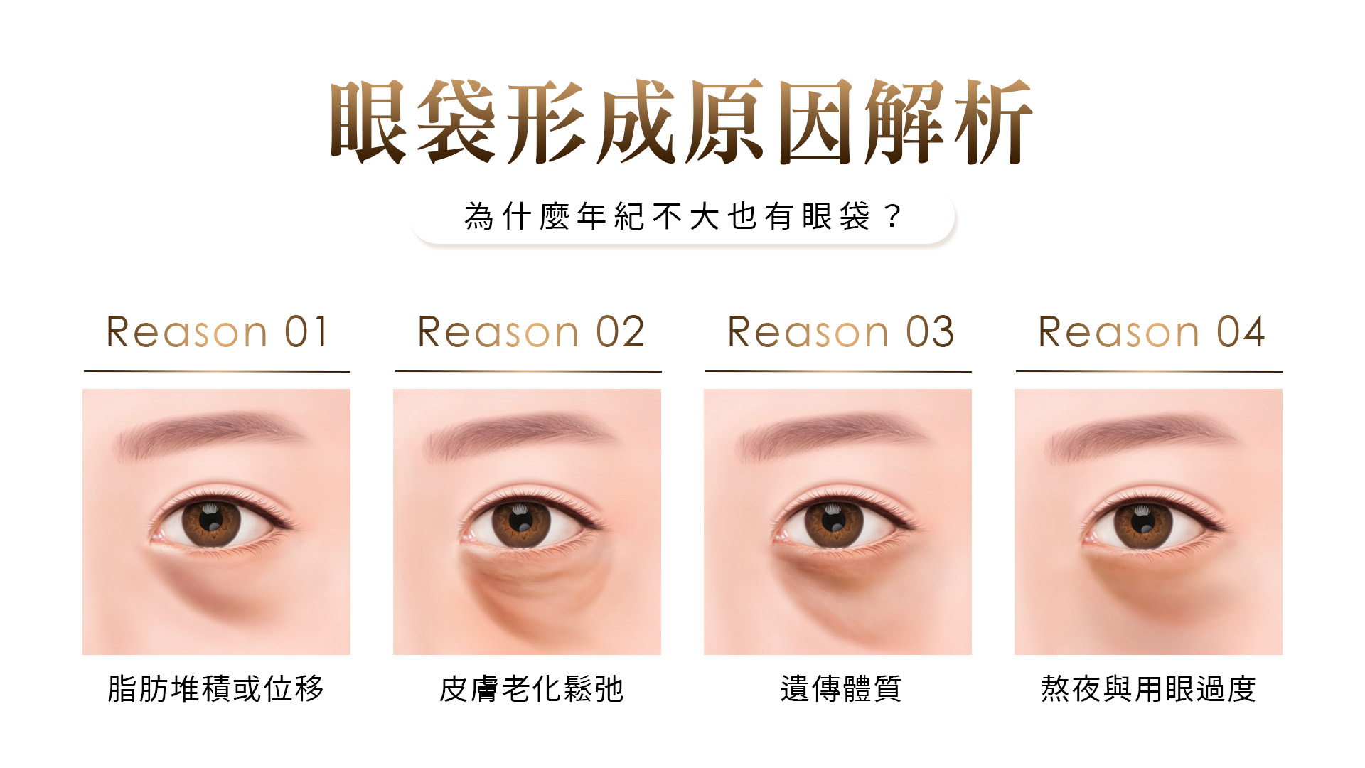 眼袋形成原因