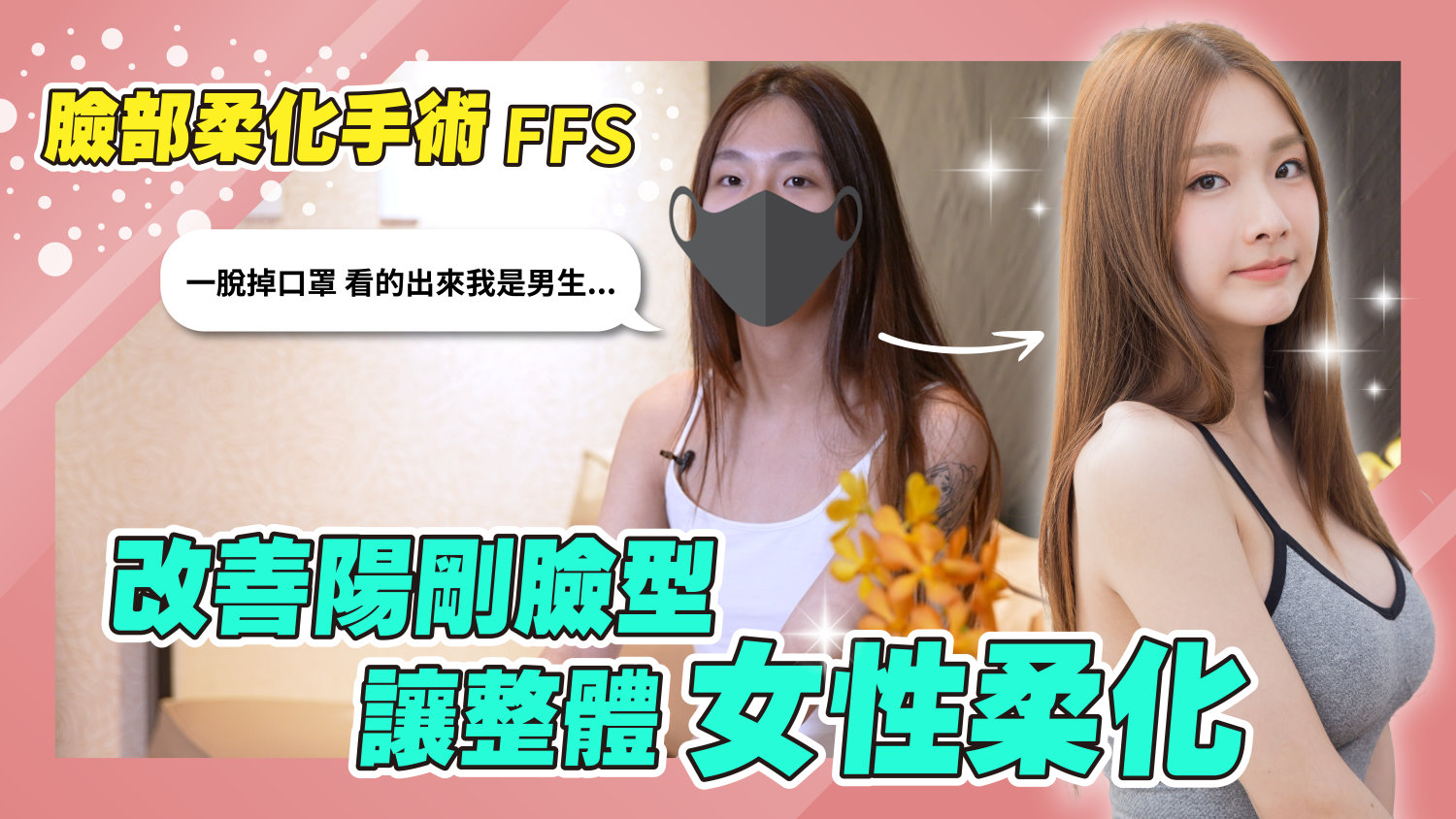 台南臉部柔化手術權威醫師推薦郭菁松醫師003